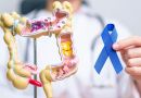 Día Mundial Contra el Cáncer de Colon