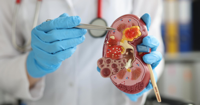 Cáncer de riñón: los síntomas silenciosos que pueden retrasar el diagnóstico Cáncer de riñón: los síntomas silenciosos que pueden retrasar el diagnóstico